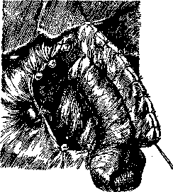 Billroth Operations on the Stomach: figure 8 from the 1928–1936 encyclopedia article