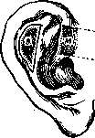 Blepharoplasty: figure 3 from the 1928–1936 encyclopedia article