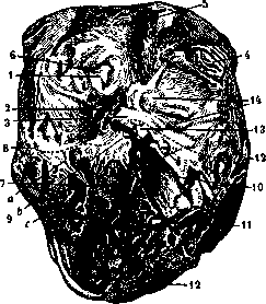 Heart Block: figure 2 from the 1928–1936 encyclopedia article