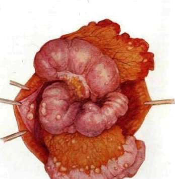 Peritoneum: figure 1 from the 1928–1936 encyclopedia article