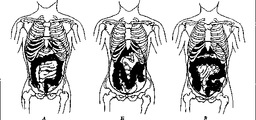 Abdominal Cavity: figure 1 from the 1928–1936 encyclopedia article
