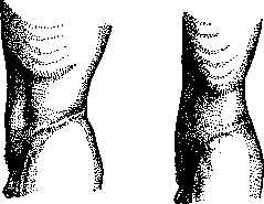 Abdominal Wall: figure 2 from the 1928–1936 encyclopedia article