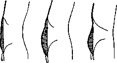 Abdominal Wall: figure 4 from the 1928–1936 encyclopedia article