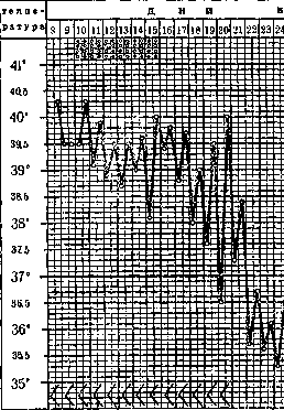 Typhoid Fever: figure 21 from the 1928–1936 encyclopedia article
