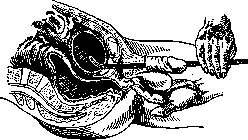 Bougienage: figure 3 from the 1928–1936 encyclopedia article