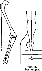 Valda Pastilles: figure 1 from the 1928–1936 encyclopedia article
