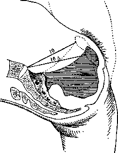 Valhera Hanging Position: figure 2 from the 1928–1936 encyclopedia article