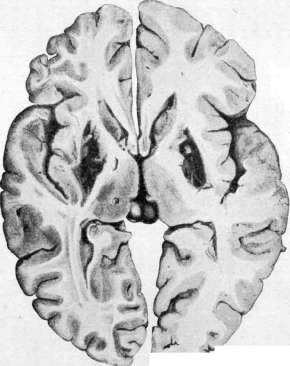 WILDUNGEN: figure 2 from the 1928–1936 encyclopedia article