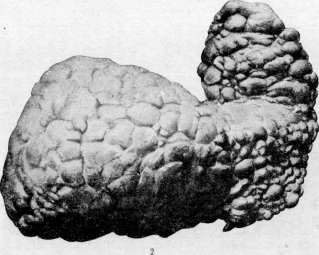 WILDUNGEN: figure 1 from the 1928–1936 encyclopedia article