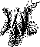 Vulvitis: figure 1 from the 1928–1936 encyclopedia article