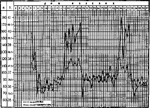 Relapsing Fever: figure 5 from the 1928–1936 encyclopedia article