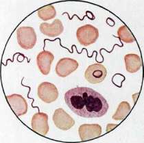 Relapsing Fever: figure 4 from the 1928–1936 encyclopedia article