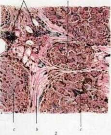 Hemofuscin: figure 1 from the 1928–1936 encyclopedia article
