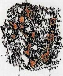 Hemofuscin: figure 2 from the 1928–1936 encyclopedia article