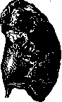 Hydronephrosis: figure 1 from the 1928–1936 encyclopedia article