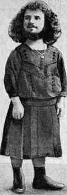 Hyrtl: figure 2 from the 1928–1936 encyclopedia article