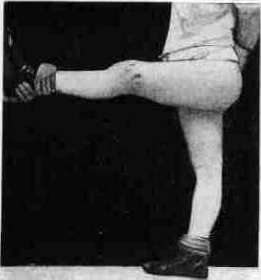 Hyrtl: figure 5 from the 1928–1936 encyclopedia article