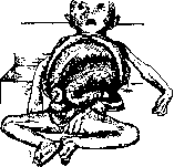 Hirschsprung Disease: figure 2 from the 1928–1936 encyclopedia article