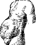Hirschsprung Disease: figure 4 from the 1928–1936 encyclopedia article