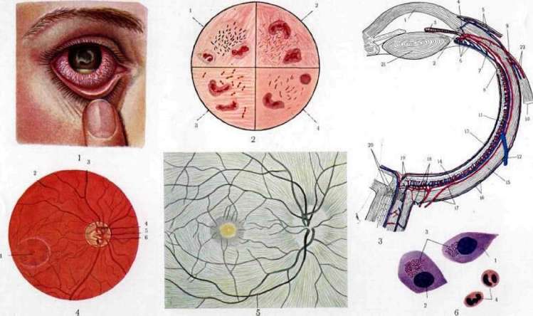 Fundus Oculi: figure 1 from the 1928–1936 encyclopedia article