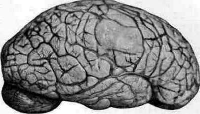 Brain (551 General diagnostics of brain diseases): figure 37 from the 1928–1936 encyclopedia article