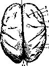 Brain (551 General diagnostics of brain diseases): figure 14 from the 1928–1936 encyclopedia article