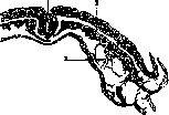Brain (551 General diagnostics of brain diseases): figure 11 from the 1928–1936 encyclopedia article