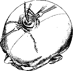 Brain (551 General diagnostics of brain diseases): figure 48 from the 1928–1936 encyclopedia article