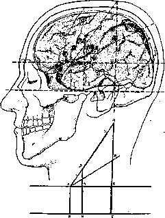 Brain (551 General diagnostics of brain diseases): figure 44 from the 1928–1936 encyclopedia article