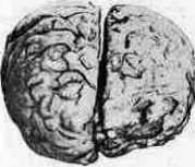 Brain (551 General diagnostics of brain diseases): figure 41 from the 1928–1936 encyclopedia article