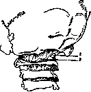 Brain (551 General diagnostics of brain diseases): figure 47 from the 1928–1936 encyclopedia article