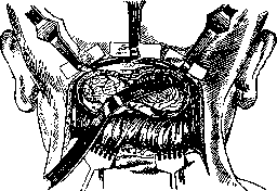 Brain (551 General diagnostics of brain diseases): figure 54 from the 1928–1936 encyclopedia article