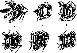 Dacryocystorhinostomy: figure 1 from the 1928–1936 encyclopedia article