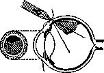 Diascopy (a954): figure 1 from the 1928–1936 encyclopedia article