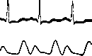 Dicrotism: figure 1 from the 1928–1936 encyclopedia article