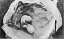 Embryo: figure 15 from the 1928–1936 encyclopedia article