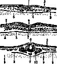 Germ Layers: figure 2 from the 1928–1936 encyclopedia article