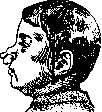 Harelip: figure 2 from the 1928–1936 encyclopedia article