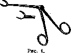 Foreign Bodies: figure 1 from the 1928–1936 encyclopedia article