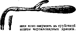 Intubation: figure 7 from the 1928–1936 encyclopedia article