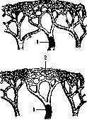 Infarction: figure 1 from the 1928–1936 encyclopedia article