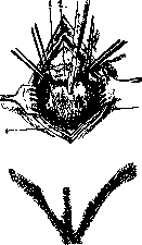Lithotomy: figure 5 from the 1928–1936 encyclopedia article