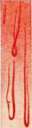 Capillaroscopy: figure 7 from the 1928–1936 encyclopedia article