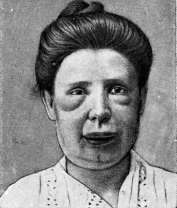 Capsules: figure 2 from the 1928–1936 encyclopedia article
