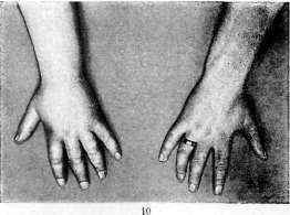 Capsules: figure 4 from the 1928–1936 encyclopedia article