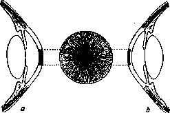 Keratoplasty: figure 1 from the 1928–1936 encyclopedia article