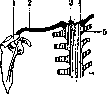 Clavicle: figure 2 from the 1928–1936 encyclopedia article