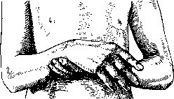 Kozhevnikov's Epilepsy: figure 2 from the 1928–1936 encyclopedia article