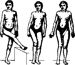 Pertussis: figure 23 from the 1928–1936 encyclopedia article