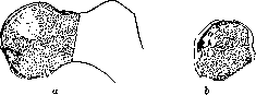 Pertussis: figure 12 from the 1928–1936 encyclopedia article
